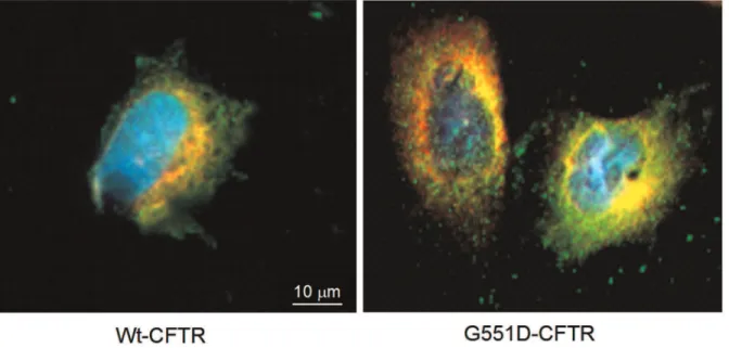 Figure 6. The calumenin – CFTR interaction takes place in the ER. Immunofluorescent localization of Calumenin within Wt- (left) and G551D- G551D-CFTR (right) expressing cells