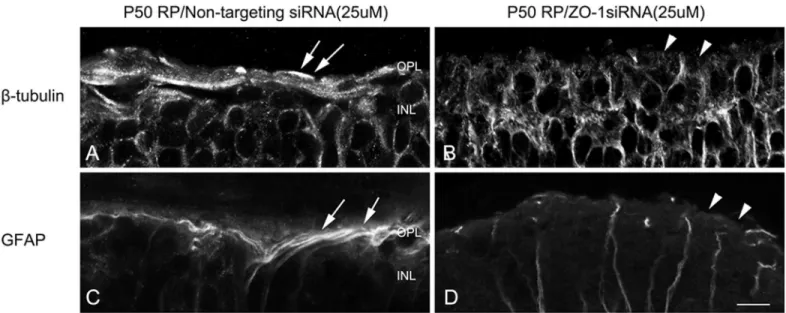 Fig 7. ZO-1 is important for the formation of glial sealing in the outer retina. Confocal micrographs of vertical sections labeled with ß-tubulin (A, B) and GFAP (C,D) in retinas treated with non-targeting siRNA (A, C) and ZO-1 siRNA (B, D)