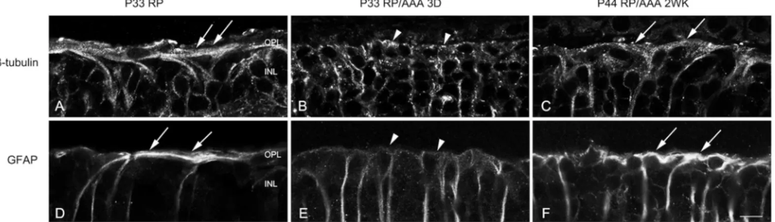 Fig 2. AAA transiently disrupts the distal glial sealing in the RP retina. Confocal micrographs of vertical sections labeled with ß-tubulin (A-C) and GFAP (D-F) in saline treated RP (A, D) and AAA treated RP retinas after 3 days (B, E) and 2 weeks (C, F)