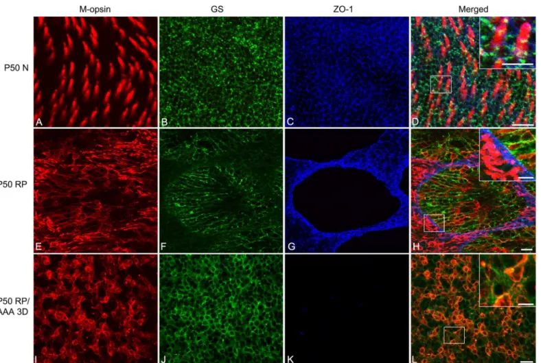 Fig 4. AAA disrupts cone rings by affecting ZO-1 expression between Müller cells and cones