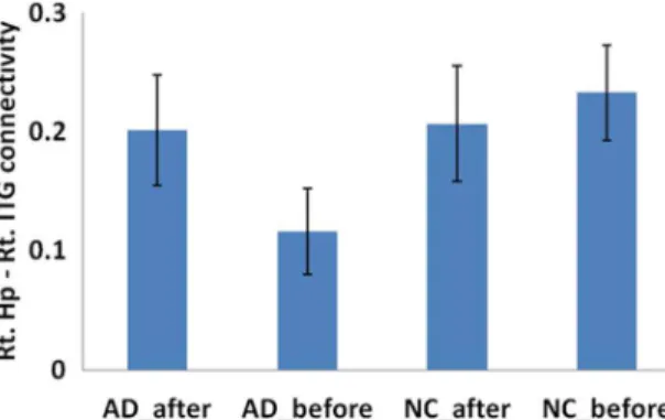 Figure 4. Comparison of connectivity of left hippocampus- hippocampus-right MPFC between pre and post acupuncture among AD patients and controls