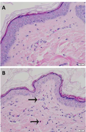 Fig. 6. A. Haired skin, head. Microscopically normal skin from the head. B. Haired skin, head