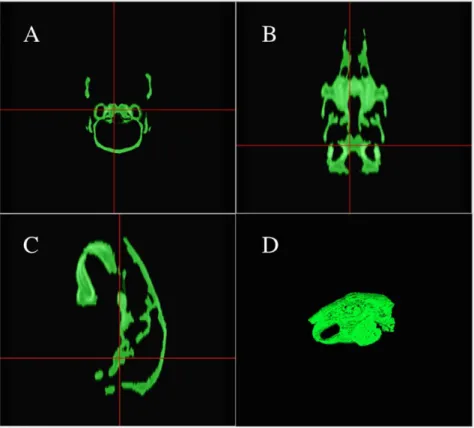 Fig. 2. Final window showing the segmented bone and summary of 3D volume parameters: Volume (mL), Mean HU, STD HU, Max HU and Min HU