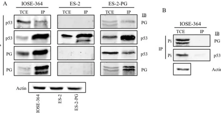 Fig 5. Interaction of plakoglobin and p53 in normal and ovarian carcinoma cell lines. Equal amounts of total cell extracts (TCE) from IOSE-364, ES- ES-2 and ES-ES-2-PG cells were processed for reciprocal and sequential immunoprecipitation (IP) and immunobl