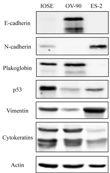 Fig 1. Protein expression of epithelial and mesenchymal markers and p53 in OVCA cell lines
