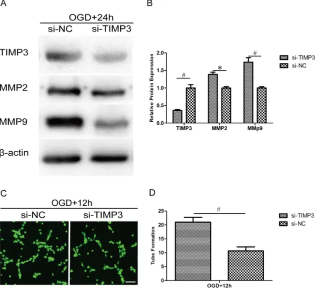 Fig 8. Silencing of TIMP3 in HUVECs promotes the expression of MMP2 and MMP9 and enhances capillary network formation