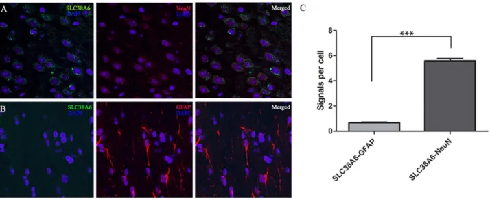 Figure 3. Confocal micrograph (63 times magnification) and PLA data confirming significantly higher expression of SLC38A6 in the neurons compared to the glial cells on paraffin-embedded tissue sections of whole mouse brain