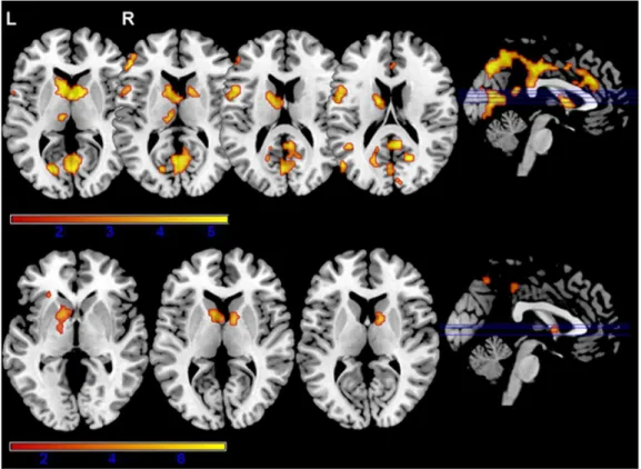 Figure 3. Brain activations for each group in the comparison between switch and repeat trials