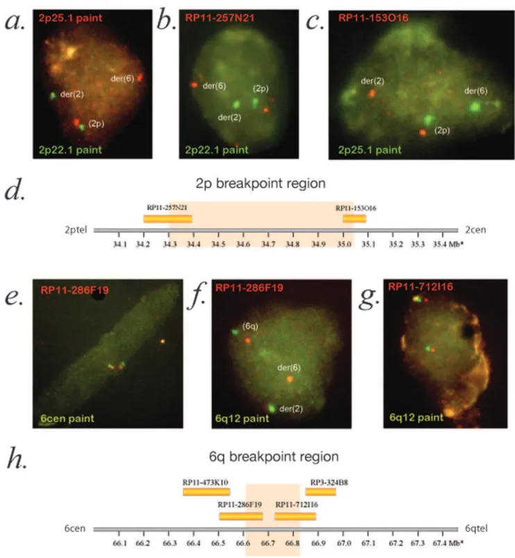 Figure 3. Mapping of the t(2;6) breakpoints using interphase FISH analysis. A. Cohybridization of mini-paints (groups of adjacently mapping BACs hybridized together) for 2p25.1 and 2p22.1 demonstrating that the normal (2p) and derivative chromosomes (der(2