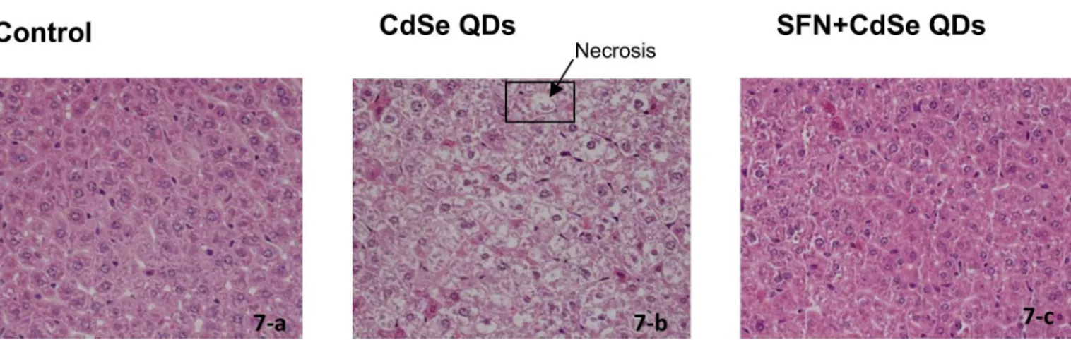 Fig 7. The protective effect of SFN against the hepatoxicity of CdSe QDs in mouse liver