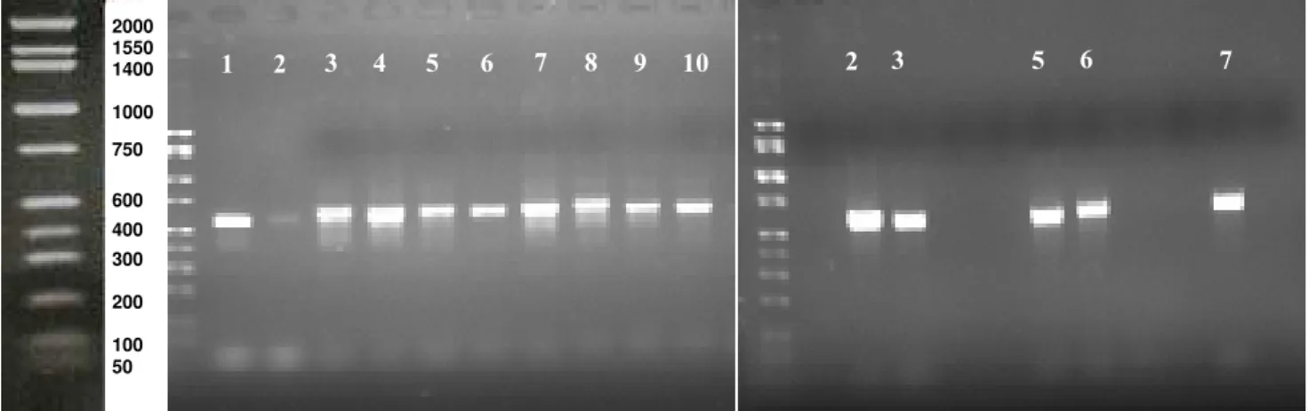 Figure 1. Electrophoresis of the PCR products of the fungal isolates in 1.5% agarose gel with ladder of 200bp with fragments fall  between 500-750bp