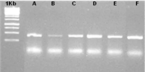 Figure 1. PCR products  for all  samples. The letters (A-F) indicate biological replicates 