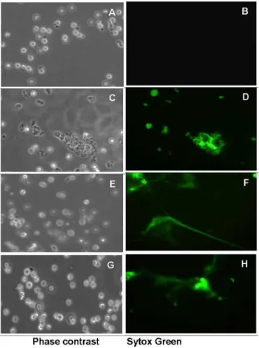 Fig 4. Induction of neutrophil extracellular traps by different concentrations of