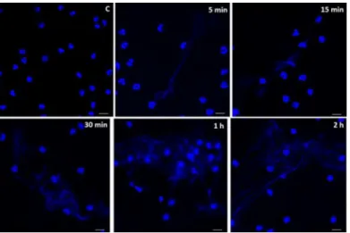 Fig 5. Kinetics of NET induction by lipopeptidophosphoglycan isolated from E. histolytica