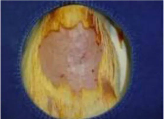 Figura 1. Antissepsia e tricotomia do abdome. 