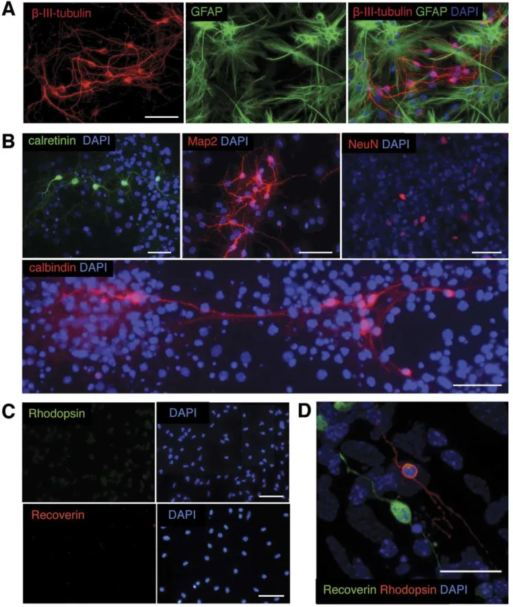 Figure 2. Differentiation of ‘RSCs’ in vitro . Following differentiation in 1% newborn calf serum expanded ‘RSCs’ showed immunoreactivity for the pan-neuronal markers b-III-tubulin (A, red) and MAP2 (B, red) or the glial marker GFAP (A, green)