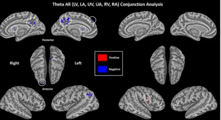 Fig 5. Supramodal correlates of theta amplitude based on conjunction analysis. (p &lt; 0.05, corrected).