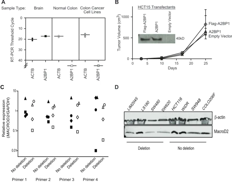 Figure 2. Expression and tumor suppressive properties of A2BP1 and MACROD2 . (A) Threshold PCR cycles for RT-PCR detection of ACTB (control) and A2BP1 in two different samples of normal brain tissue, four different samples of normal colon tissue, and 19 co