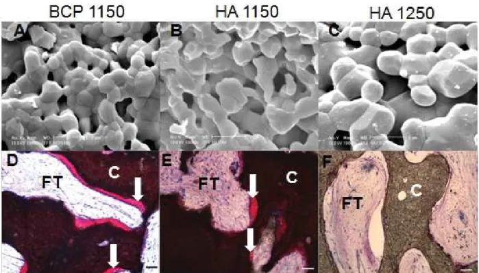 Fig. 2. The effect of chemical composition and microstructure of calcium phosphate ceramics on bone formation