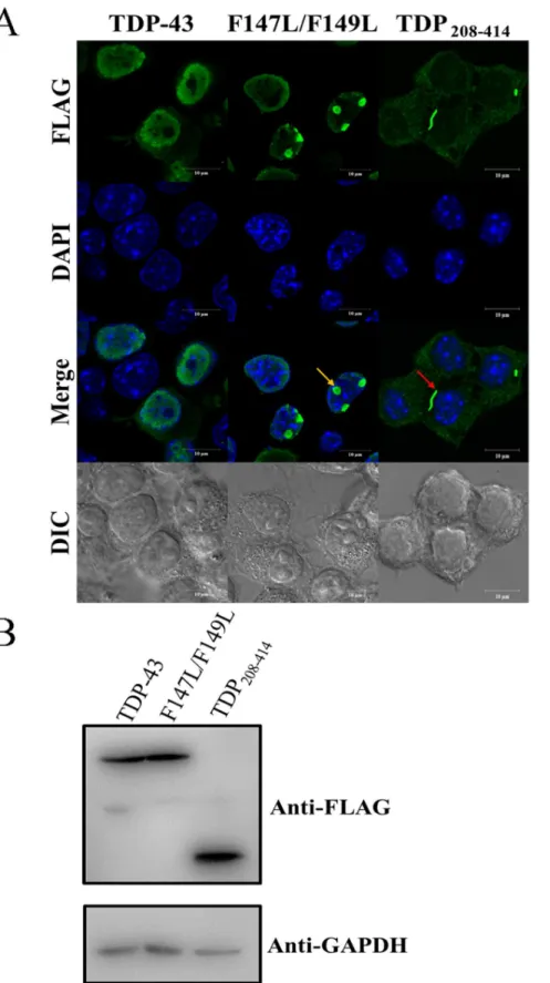 Figure 5. Confocal immunofluorescent images of Neuro2a cells of TDP-43 variants. (A) Inclusions were observed only in the mutant (F147L/F149L, indicated by yellow arrow) and truncated (TDP 208–414 , indicated by red arrow) TDP-43 rather than the wild-type 