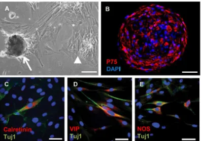 Fig 2. Appearance of neurosphere like-bodies and expression of neuronal markers by neurosphere cells derived from aganglionic Hirschsprung gut