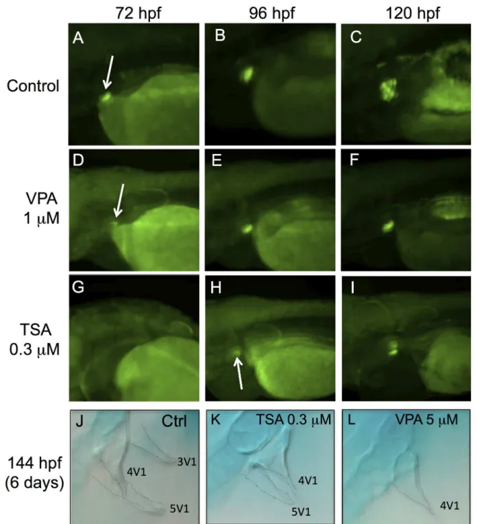 Fig 6. VPA and TSA delay the formation of pharyngeal teeth. The development of pharyngeal teeth was analyzed at 72 hpf, 96 hpf and 120 hpf