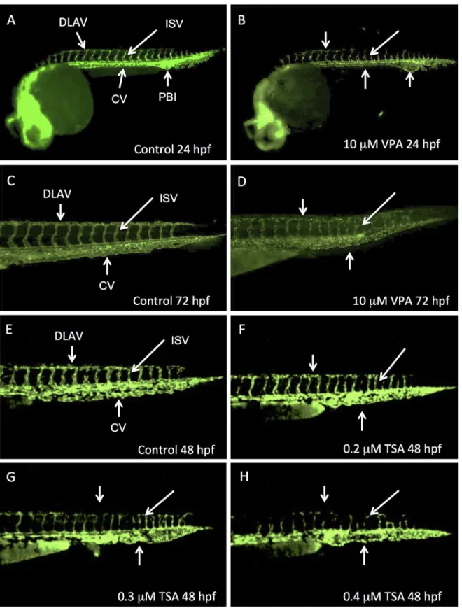 Fig 1. VPA and TSA perturb the development of vascular system. Lateral views of Fli1-EGFP whole embryos at 24 hpf (A, B) or of their caudal part at 48 hpf (E-H) or 72 hpf (C, D)
