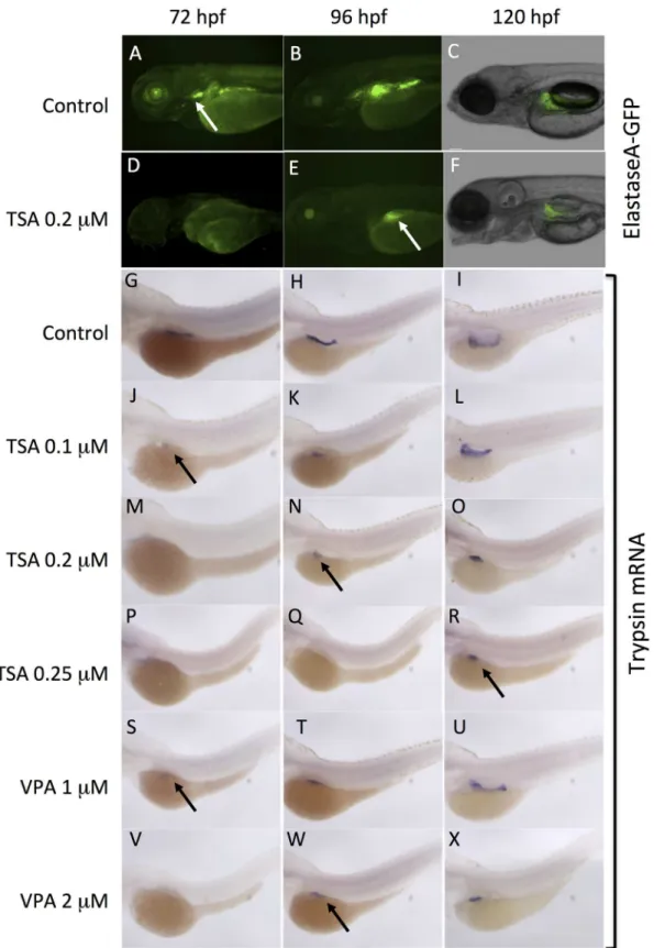 Fig 4. VPA and TSA delay the development of exocrine pancreas. The development of exocrine pancreas was analyzed at 72 hpf, 96 hpf and 120 hpf.