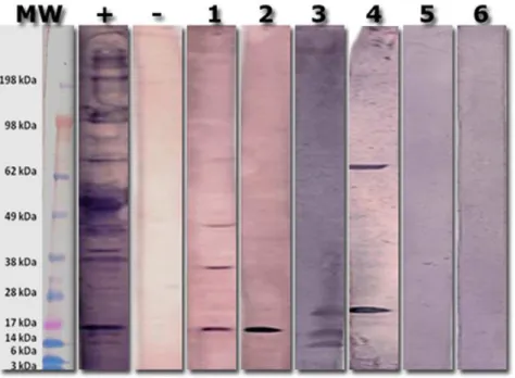 Figure 1. Representative Western blot for the detection of Chlamydia -specific IgE. Whole C