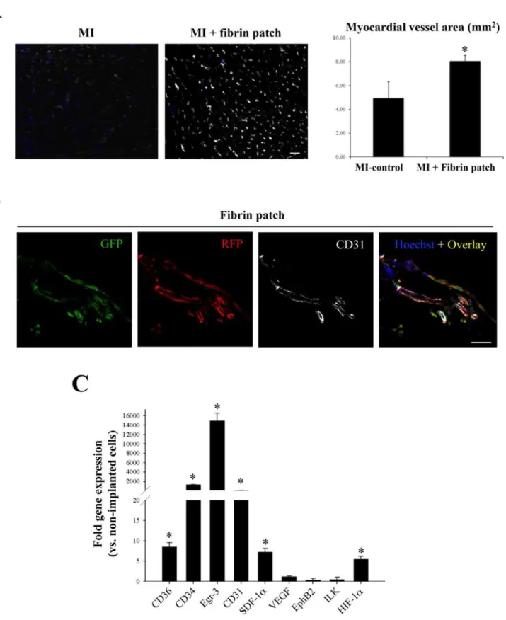 Figure 6. Increased revascularization of infarcted myocardium following fibrin patch delivery