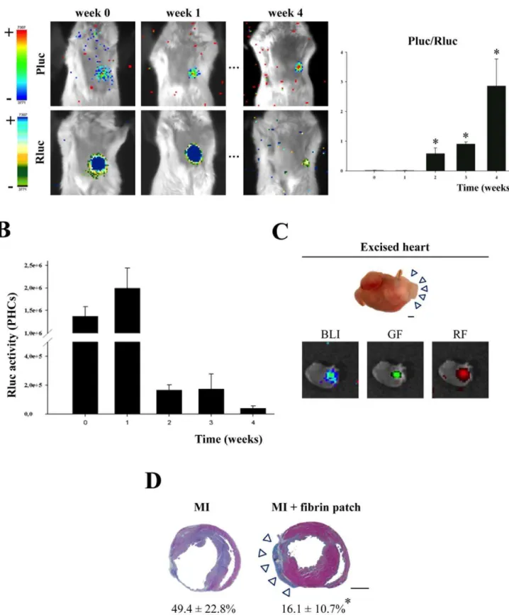 Figure 5. Reduction of infarct size by implantation of an UCBMSC-embedded fibrin patch