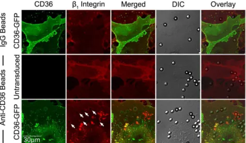 Figure 8. b 1 integrin recruitment by adherent anti-CD36 coated beads on HMEC-1. HMEC-1 monolayers in ibidi chambers transduced with GFP-CD36 were incubated with beads coated with IgG 1 or anti-CD36 for 30 min at 37uC in 5% CO 2 