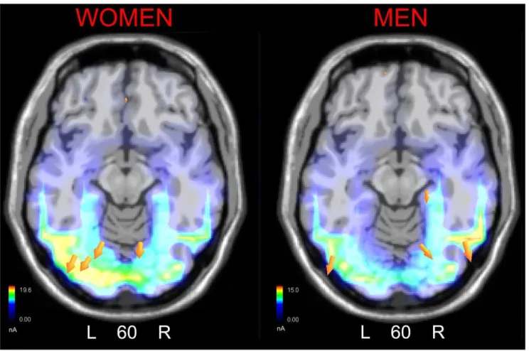 Figure 4. SwLORETA inverse solution performed on brain activity recorded during the 135–175 ms time window in response to adult faces in the two sexes.
