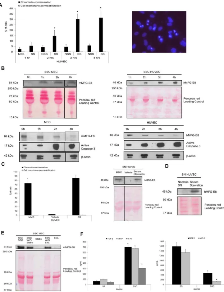 Figure 1. Apoptotic EC-conditioned media contain MFG-E8 and reprogram macrophages. A Percentage of cells with increased chromatin condensation and cell membrane permeabilization (as evaluated with HO and PI staining) in HUVEC exposed to normal medium with 
