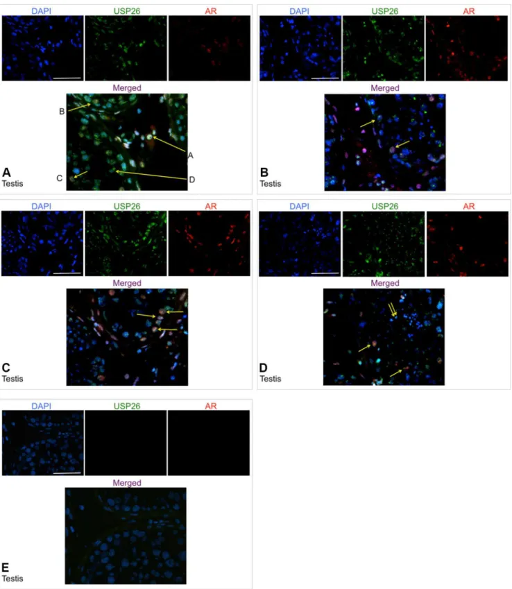 Figure 3. USP26 and AR protein expression in normal testis by immunofluorescence. All images of stained sections were captured at 400x total magnification; scale bar = 100 mm