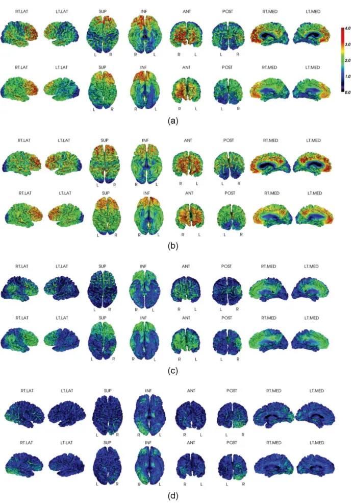 Figure 3. Visual Inspection for PiB measurements. Surface-based PiB measurements from the MRI-dependent method (the top row) and the proposed method (the bottom row) for four examples: (a) AD, (b) PiB + NC, (c) PiB + NC, and (d) PiB- NC.