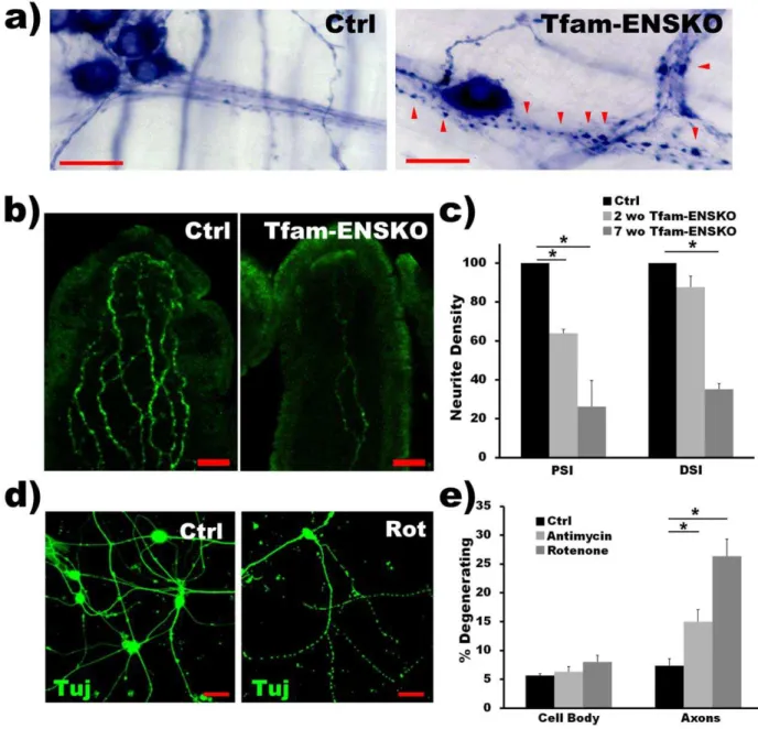 Figure 5. Axonal degeneration is present in Tfam-ENSKO mice and may precede enteric neuron loss