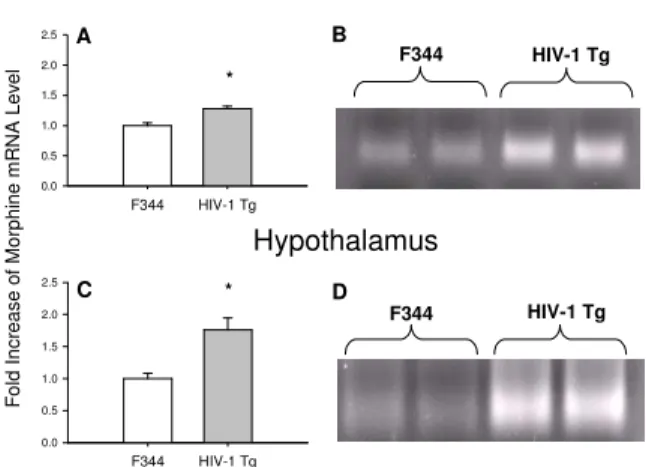 Fig. 3:  Expression  of  MOR  mRNA  levels  in  the  rostral  brain  and  hypothalamus  of  HIV-1  Tg  rats