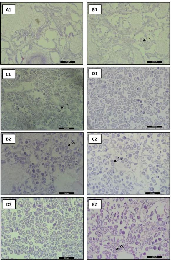 Figura  2.2.  Fotomicrografias  que  mostram  os  diferentes  estádios  de  desenvolvimento  das  gónadas  femininas de Ruditapes decussatus (A1-D1) e de Ruditapes philippinarum (B2-E2)