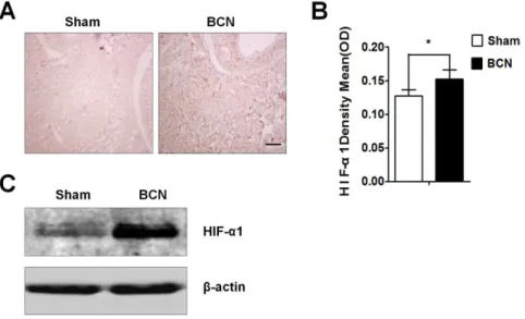 Figure 1. Expression of HIF-1 a in the corpus cavernosum tissues of BCN rats. (A) Rats were killed at 12 weeks after BCN, and penis samples were prepared for detection of HIF-1a expression using immunohistochemical staining (1006 , Scale bars = 200 mm)