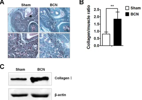 Figure 2. Analysis of corpus cavernosum tissue fibrosis in BCN rats. (A) Penis samples were prepared for the detection of corpus cavernosum tissue fibrosis using Masson trichrome staining (Upper-line: 406 , Scale bars = 500 mm, down-line: 1006 , Scale bars