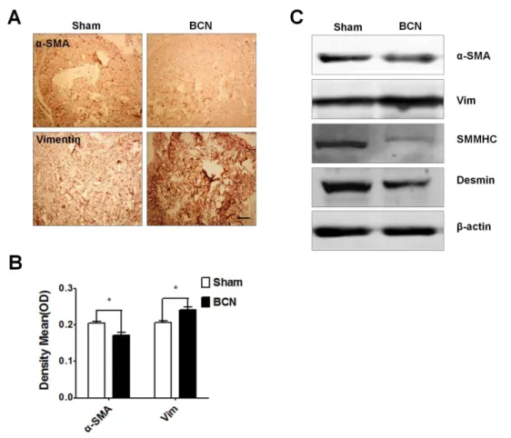Figure 4. Measurement of the phenotypic modulation of CCSMCs in BCN rats. (A) Representative immunohistochemical staining photomicrographs for smooth muscle a-actin (a-SMA) and vimentin proteins (1006 , Scale bars = 200 mm)