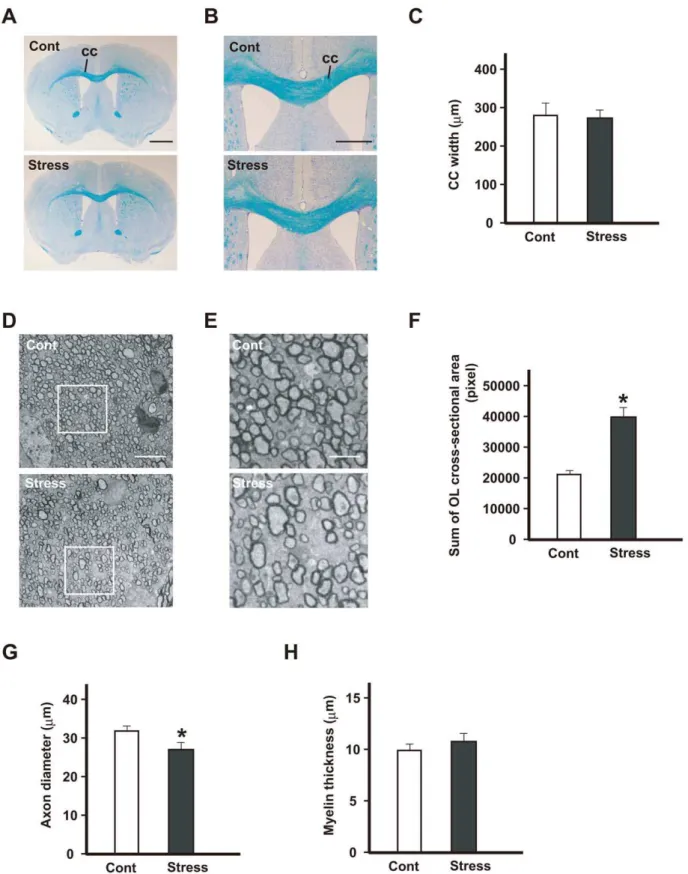 Figure 7. Repeated exposure to WIRS causes morphological alterations in oligodendrocytes in the corpus callosum