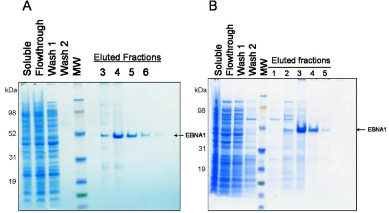 Figure 5. Immunoaffinity chromatography using PR-mAbs. The soluble fraction of whole cell extract from E