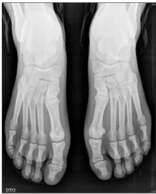 Figura 9 (Caso clínico 2). Radiografia dos joelhos AP