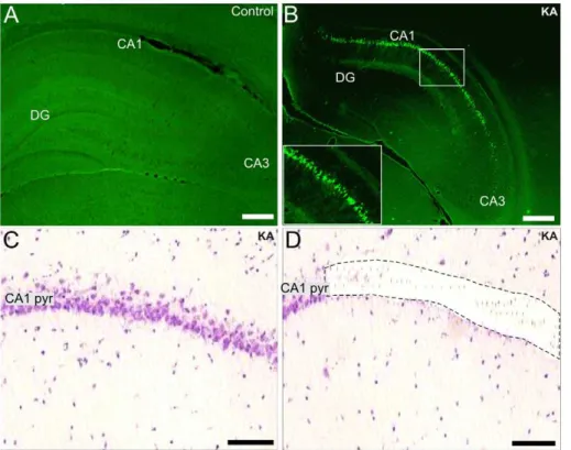 Figure 1. Neuronal CA1 pyramidal cell damage and the region-specific laser microdisecction one week after SE
