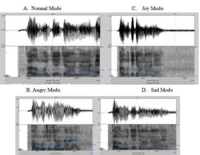 FIG 1 REPRESENTS THE GRAPHICALLY DIFFERENT EMOTIONS OF A PARTICULAR SENTENCE 
