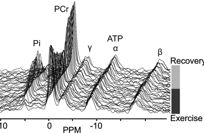 Figure 3.  Bar plot Pi 2 /Pi 1  ratio trained/untrained.  Bar plot of Pi β /Pi 1   ratio  with  a  significant  higher  Pi β /Pi 1   in  the  endurance trained athletes (0.07 ± 0.01) compared to the normal physical active group (0.0γ ± 0.01) (P < 0.05).