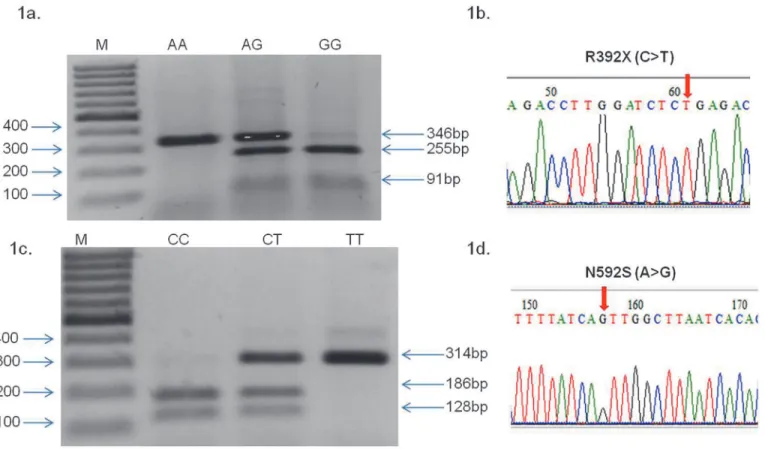Fig 1. RFLP profiling of TLR5 R392X (C &gt; T), N592S (A &gt; G) and sequencing chromatogram