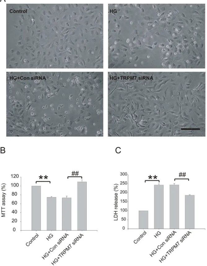 Figure  3.    Effect  of  TRPM7  siRNA  on  viability  and  cytotoxicity  in  HG  treated  HUVECs